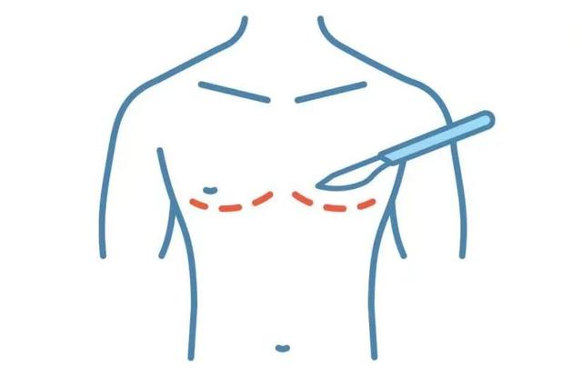 因?yàn)樾靥?，我，被分手? onerror=