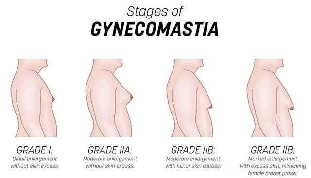 因?yàn)樾靥?，我，被分手? onerror=
