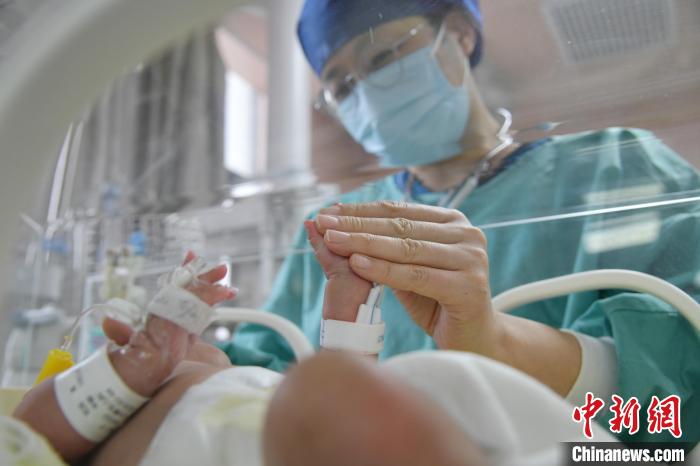 胎齡僅24周 武漢一“巴掌寶寶”獲成功救治