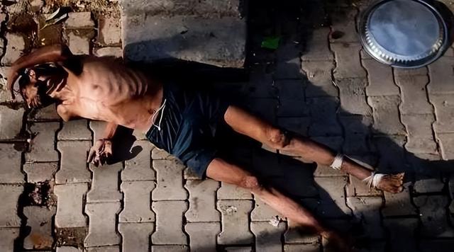 “丫丫”到底怎么了？骨瘦如柴、毛發(fā)脫落 → 網(wǎng)友：像吸毒了一樣！